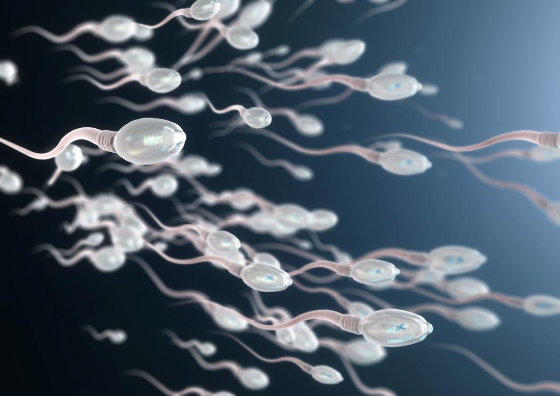 Sperm are not moving