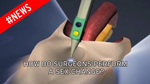 Surgery to make pussy into dick