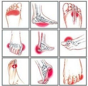 Unexplained pain bottom foot