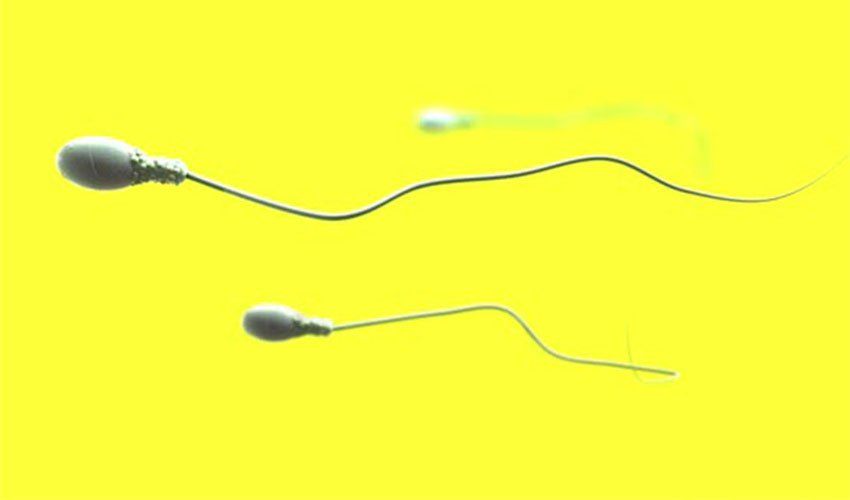 best of Sperm in Yellow tint